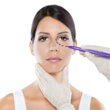 Blefaroplastia Blefaroplastia
